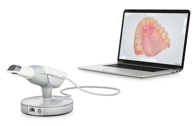 scans scanner intraorale